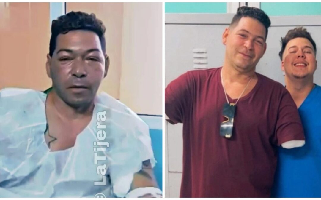 Liniero cubano reaparece tras perder ambos brazos en accidente